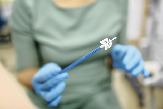 Solidaris waarschuwt voor co-testing bij cervixkankerscreening